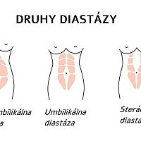 Druhy diastázy